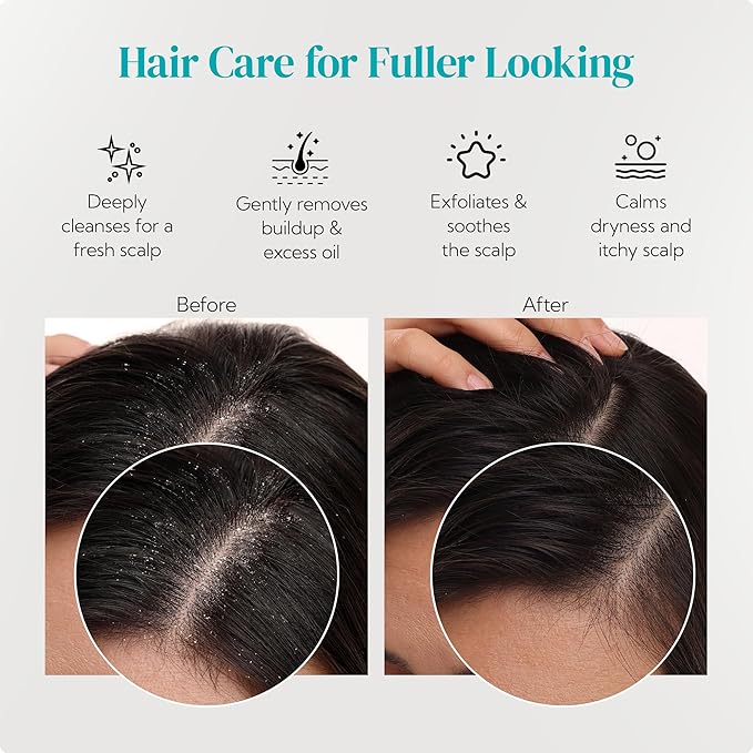 HEETA Scalp Massager 2 Pack for Hair Growth, Soft Silicone Bristles to Remove Dandruff and Relieve Itching, Scalp Scrubber for Hair Care Relax, Shampoo Brush for Wet Dry Use Blue & Beige