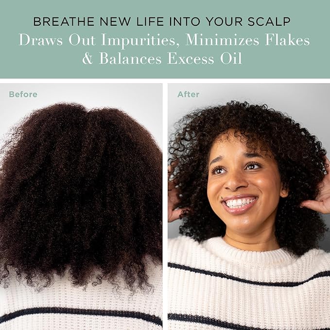 Unwash Charcoal Detox Scalp Scrub - Detoxify, Exfoliate, & Rebalance Hair & Scalp, Removes Build-Up, For Dry, Itchy Scalps Paraben Free, 8.82 oz