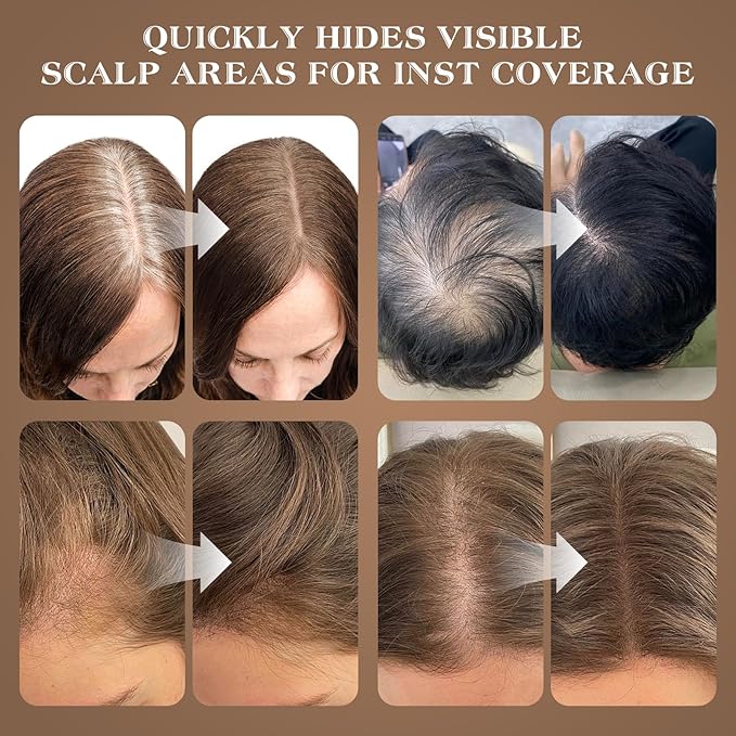 Hairline Shadow Powder, Auburn, Root Touch Up Powder for Instantly Gray Hair Cover Up, Women Color Root Coverage for Thinning Grey, Mens Roots Concealer for Hair Loss Beard Line, #9