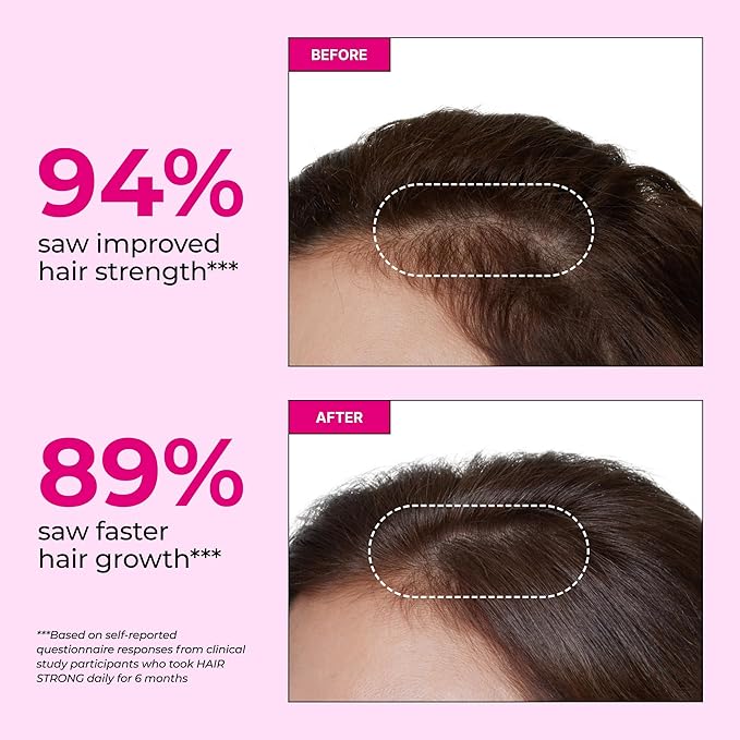 HUM Hair Strong Daily Hair Growth Supplement with Biotin, Zinc, Vitamin B12 to Support Growth, Folic Acid & Vitamin B12 Vitamins for Healthy Hair Support for Women and Men, 30 Vegan Capsules