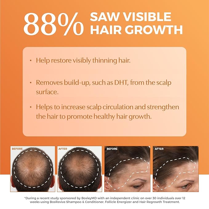 BosRevive Nourishing Shampoo for Thinning Hair (Color Safe) – DHT Blocker, Sulfate-Free, Vegan Formula with Biotin, Saw Palmetto & Rosemary – Strengthens & Volumizes – 33.8 Fl Oz