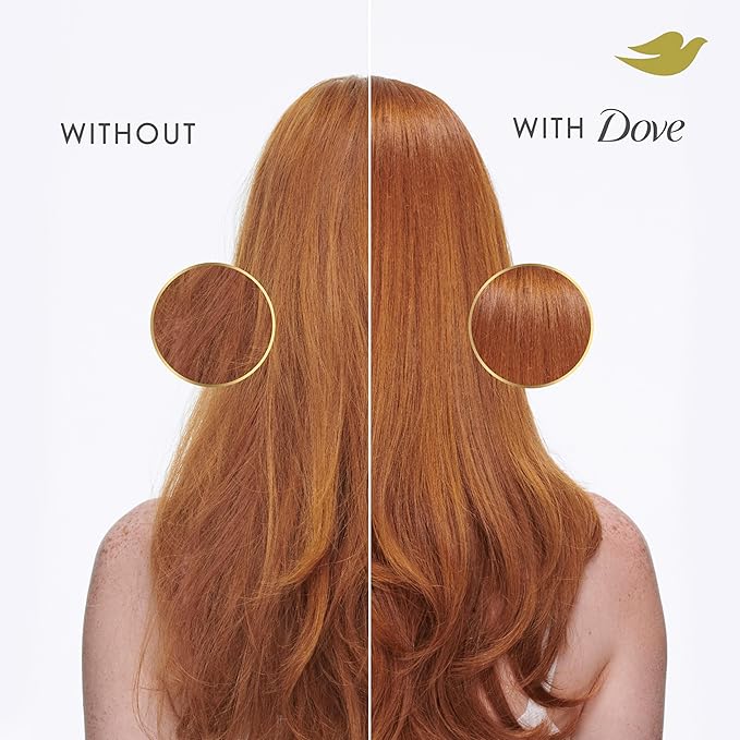 Dove Hair Intensive Repair 10in1 Serum Mask for Damaged Hair with Bio-Protein Care Technology and Amino Serum 9.2 fl oz