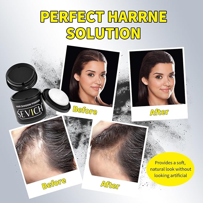 Sevich Hairline Powder 10g with Brush, Instantly Conceals Hair Loss & Thinning & Gray, 48H Waterproof Root Touch Up Powder, Natural Hair Shadow Toppers for Women & Men, 1 Box = 2.5 Boxes,Black
