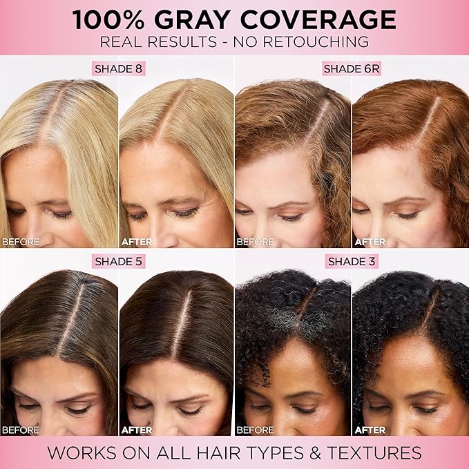 L'Oreal Paris Excellence Crème Permanent Hair Dye, Triple Care Hair Color with Pro-Keratine Complex for 100% Gray Hair Coverage, 9.5NB Lightest Natural Blonde, 1 Kit