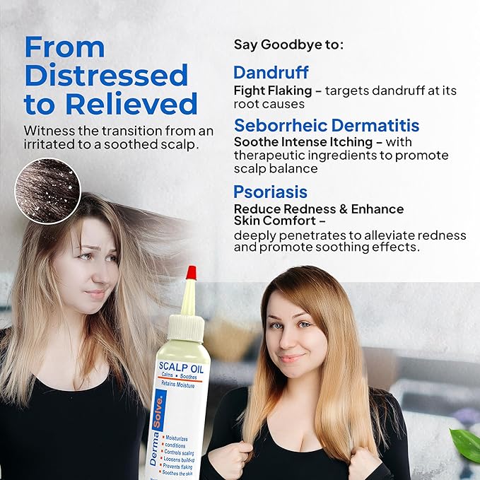 Dermasolve 4 oz Psoriasis, Seborrheic Dermatitis, & Dandruff Scalp Oil - Dermatologist Approved - Flaky Scalp Relief, Clinically Tested, Long-Lasting Itch-Free, High-Performance Formula