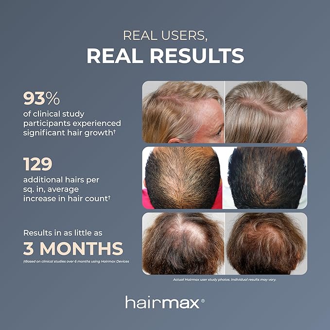Hairmax PowerFlex 272 Laser Cap - (FDA Cleared) Thinning Hair Loss Solution for Men & Women - Flexible Cordless Design With 7 Minute Treatment Time - Red Light Therapy to Stimulate Hair Growth